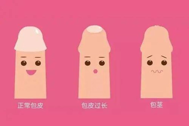 包皮手术多少钱