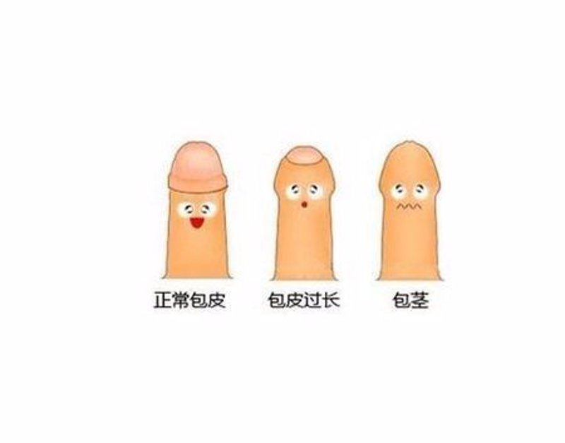 性功能障碍:困扰男性的隐形杀手