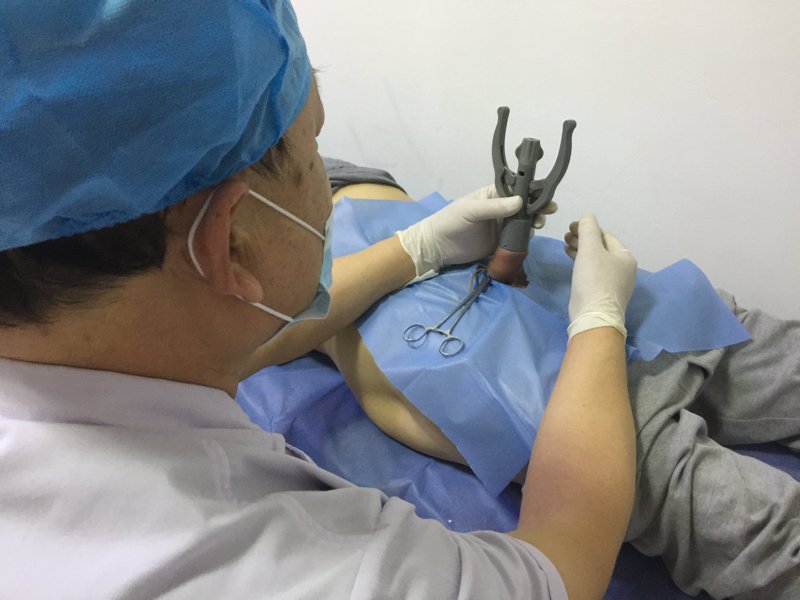 性功能障碍:男性健康的重要议题
