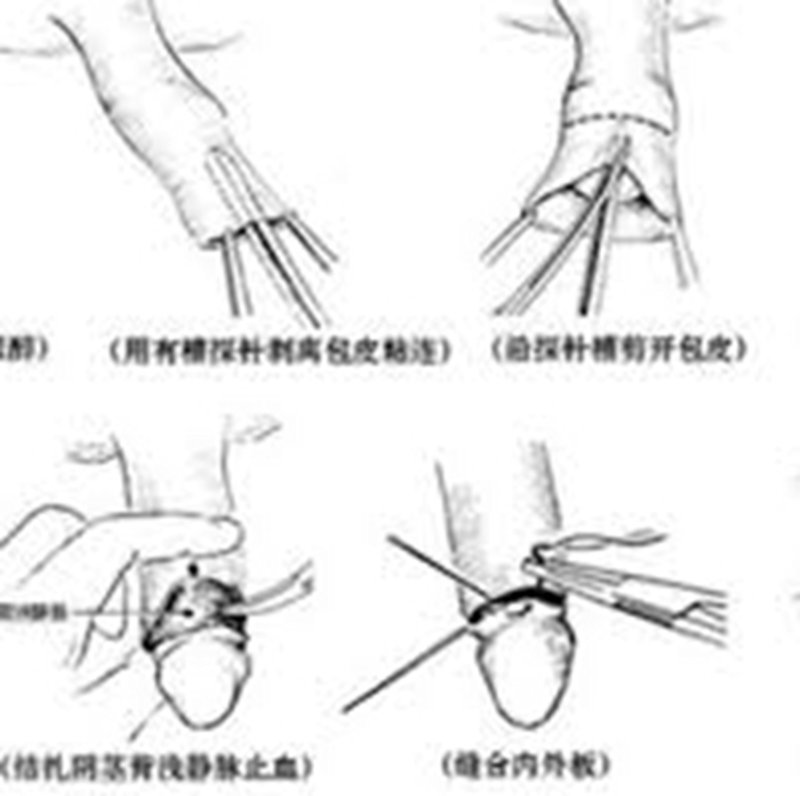 性功能障碍:了解其十大常见表现